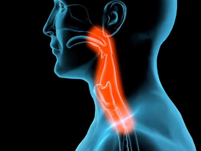 التهاب حنجره یا لارنژیت چیست