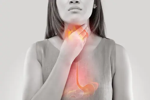 سوزش حنجره بر اثر رفلاکس معده