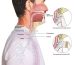 همه چیز درباره عمل حنجره برای تغییر صدا - میزان تاثیرگذاری -عوارض و مزایا و معایب