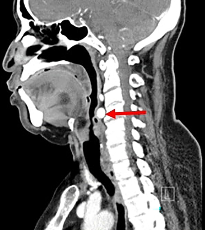 انواع مختلف روش های عکس برداری از حنجره و حلق کدام است و هر کدام برای تشخیص چه چیزهایی کاربرد دارد؟