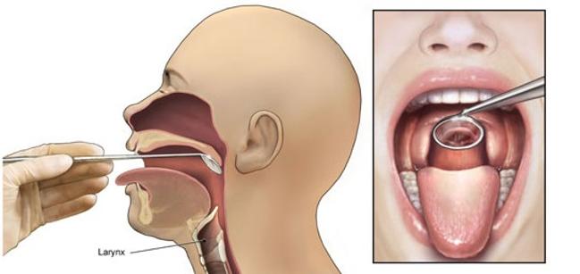 انواع مختلف روش های عکس برداری از حنجره و حلق کدام است و هر کدام برای تشخیص چه چیزهایی کاربرد دارد؟